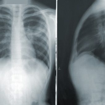 cdc NMZdj2Zu36M unsplash cdc NMZdj2Zu36M unsplash